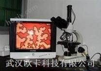 武汉欧卡 精字检测仪 三目高清显微镜